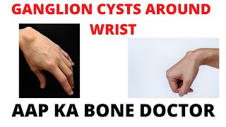 GANGLION CYSTS AROUND WRIST - EPISODE 9