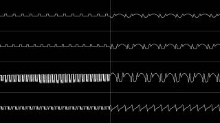 Metal Gear 2 (MSX) - "Nightfall" (2A03+VRC7 Cover) [Oscilloscope View]