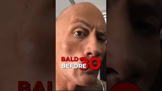 You Are Going To Bald (Takla) 🥴 - 88/365 l #monstermindsett #transformation