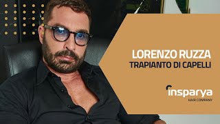 Trapianto di Capelli di Lorenzo Ruzza | Insparya