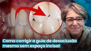 COMO CORRIGIR A GUIA DE DESOCLUSÃO MESMO SEM ESPAÇO - Mylene e Renato