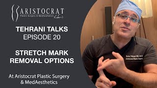 Tehrani Talks 20: Stretch Mark Removal