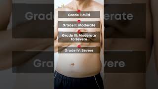 Gynecomastia types of Grades and Differents #gynecomastiatreatment #grades