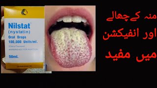 nilstat drop uses and benefits in urdu hindi ||mu ka chaloun or infection ka lia || medic  official