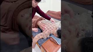 Cupping therapy for pain relief & improve blood circulation | POORNIMA SHARMA #physiotherapy #bpt