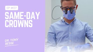 Same-Day Crowns With CEREC Technology | Affinity Dental