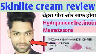 Hydroquinone tretinoin mometasone furoate cream | Skinlite cream