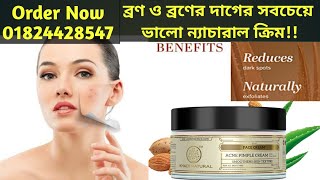 Khadi Acne Pimple Cream || ব্রণ ও ব্রণের দাগের সবচেয়ে ভালো খাদির ন‍্যাচারাল ক্রিম!!