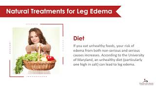 Natural Treatments for Swollen Legs