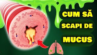 6 CAUZE REALE ALE FLEGMEI ȘI MUCUSULUI DIN GÂT!  CUM SĂ SCAPI UȘOR DE MUCUSUL DIN GÂT ȘI NAS!