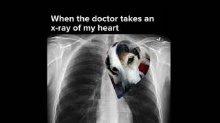 When the Doc Xrayed My Heart