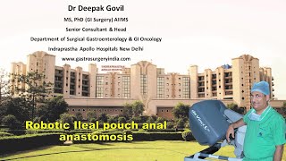 Robotic Ileal Pouch Anal Anastomosis (IPAA) by Dr Deepak Govil, GI Surgeon, Apollo Hospital, Delhi