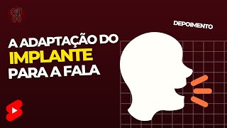 A adaptação do implante para a fala - depoimento de um paciente de implante