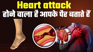 हार्ट अटैक के लक्षण, symptoms of heart attack.