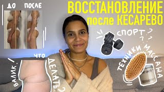 ВОССТАНОВЛЕНИЕ после родов. ОСЛОЖНЕНИЕ после кесарево. серома. ВАЛИК над швом.