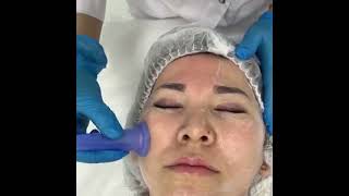 Скульптурный массаж лица в CosmoDerm Laser clinic