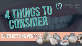 4 Things to Consider When Getting Veneers #DentalVeneers #CosmeticDentistry #PorcelainVeneers