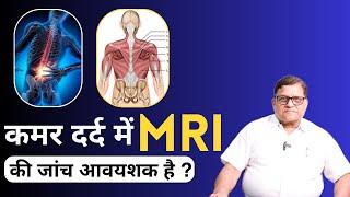 कमर दर्द में MRI की जांच कब करवाना चाहिए ? और किस स्थिति में एम.आर.आई. की आवश्यकता नहीं पड़ती है