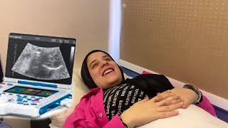 اول زيارة مع ماما  للدكتور🤰 شافت البيبي❤