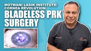 Bladeless PRK (Photorefractive Keratectomy) Surgery