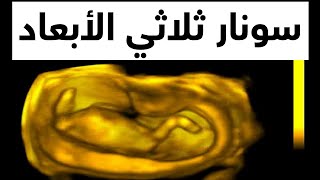 3D Pregnancy سونار ثلاثي الأبعاد على الحمل سونار رباعي الأبعاد دكتور يوسف عيد DR YUSSIF EID 2024