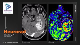 Neurorad quiz-1