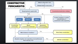 Constrictive Pericarditis signs in a case.