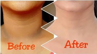 Clean your black neck.||||||| کالی گردن صاف کرنے کا طریقہ |||||| how to clean black neck