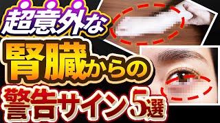 【放置厳禁】絶対見逃してはいけない腎臓が悪い時に出る症状について専門医が解説します。