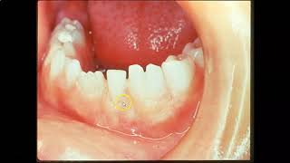 Abnormalities of Teeth 35 minutes