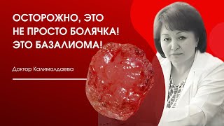 Осторожно, это не просто болячка! Это базалиома!