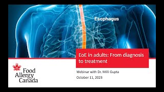 Webinar: EoE in adults: From diagnosis to treatment