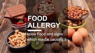 Signs That Your Child has Food Allergies