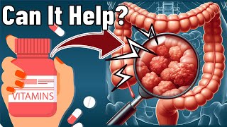 Can Vitamins Actually PPREVENT Colon Cancer?