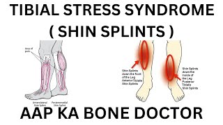 TIBIAL STRESS SYNDROME (SHIN SPLINTS) - EPISODE 67