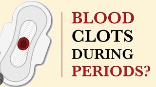 Blood clots dangerous for conceiving