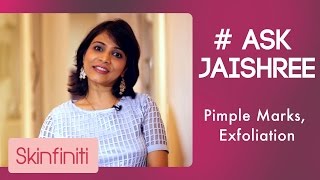 Pimple Marks And Exfoliation || #AskJaishree Episode 3 || Skinfiniti