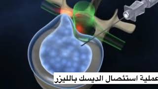 من خدمات مركز الشرف التخصصي للعظام والعمود الفقري