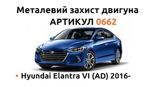 Установка металлической защиты двигателя КОЛЬЧУГА для Hyundai Elantra 6 AD