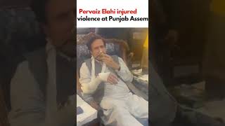 #PervaizElahi has been injured as the PML-N MPAs attacked him in the violence at $PunjabAssembly