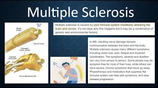 MS, Multiple Sclerosis, Roze pharm