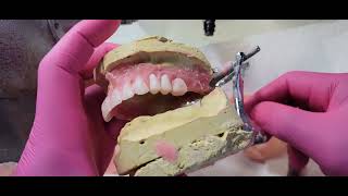 "Watch How Denture Teeth Are Perfectly Set: Step-by-Step Craftsmanship Tutorial!"