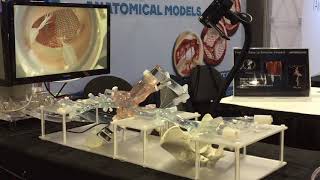 Enhanced Transseptal Mitral Model