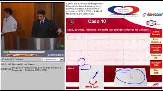 06 Bloqueios fasciculares dos ramos direito e esquerdo. Critérios ECG. VCG