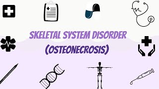 Osteonecrosis (Avascular Necrosis)