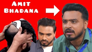 AMIT BHADANA|Latest|Hair|Transplant|patch|hindi|fall|MINOXIDIL|FINASTERIDE|results|solution|before