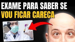 COMO SABER SE VOU FICAR CARECA? O MELHOR EXAME!