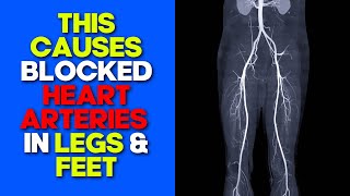 10 Signs of Blocked Arteries in YOUR Legs & Feet ⚠️ 🦵 🦶 excellent health insights