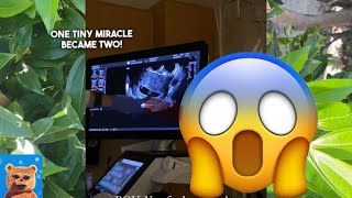 How mama found out she is having two babies in her womb 😮 #how #viralvideo #manifestation