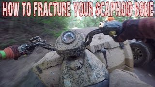 Sportsman 570 at Brimstone ATV Park - Huntsville TN - How to Fracture your scaphoid bone!